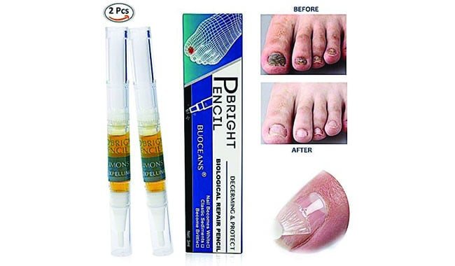 10 Best Fungal Nail Treaments in 2020 Topical, Balms and ...