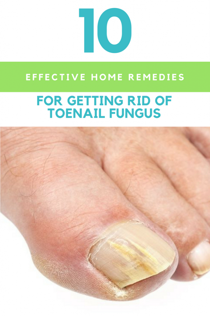 10 Effective Home Remedies For Getting Rid Of Toenail Fungus ...