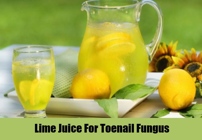 10 Natural Cures for Toenail Fungus