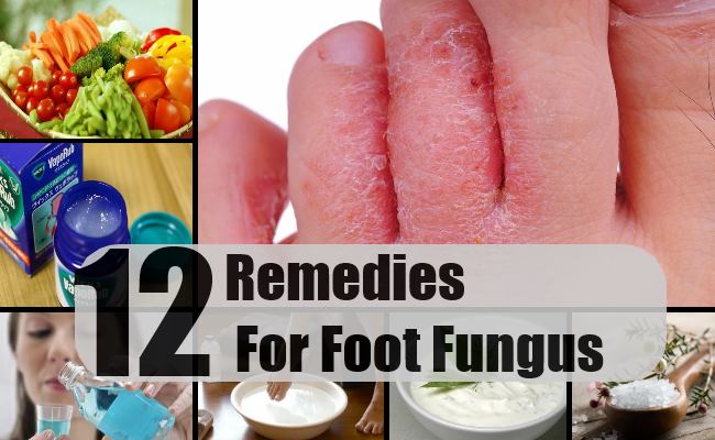 12 Home Remedies For Foot Fungus