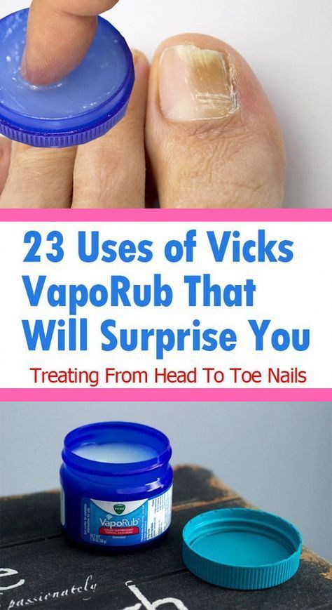 20 Great Uses of Vaseline Which You Probably Donât Know ...