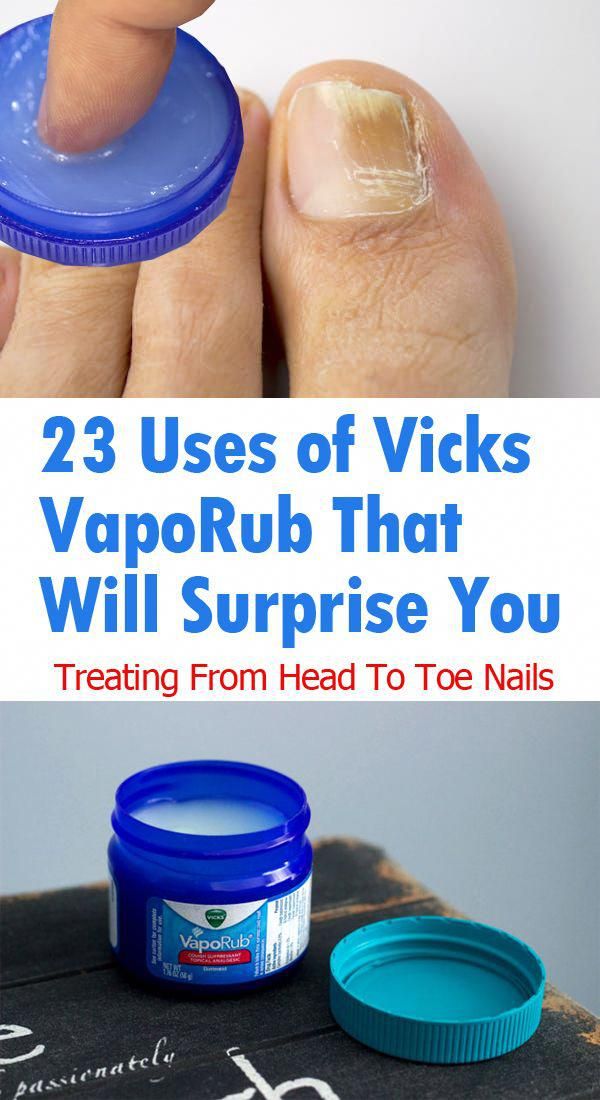 23 Brilliant Health and Beauty Uses of Vicks VapoRub ...