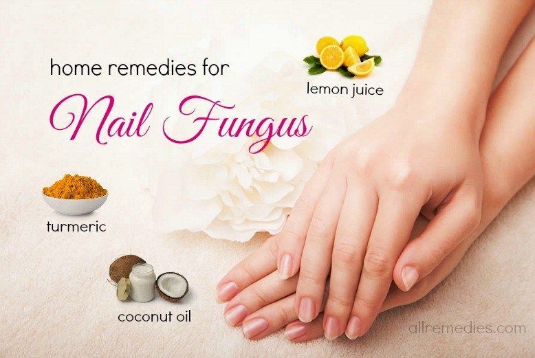 25 Natural Home Remedies for Nail Fungus Infections ...