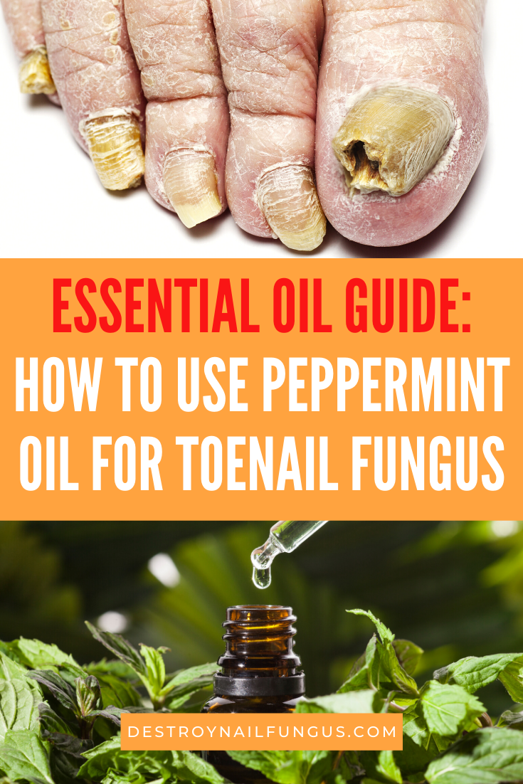 3 Great Reasons To Use Peppermint Oil For Toenail Fungus