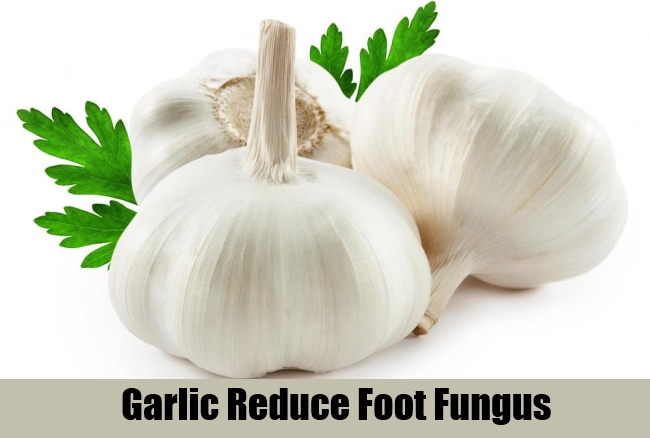 5 Best And Effective Ways To Treat Foot Fungus
