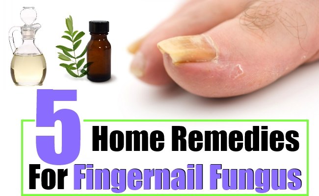 5 Home Remedies For Fingernail Fungus  Natural Home Remedies &  Supplements