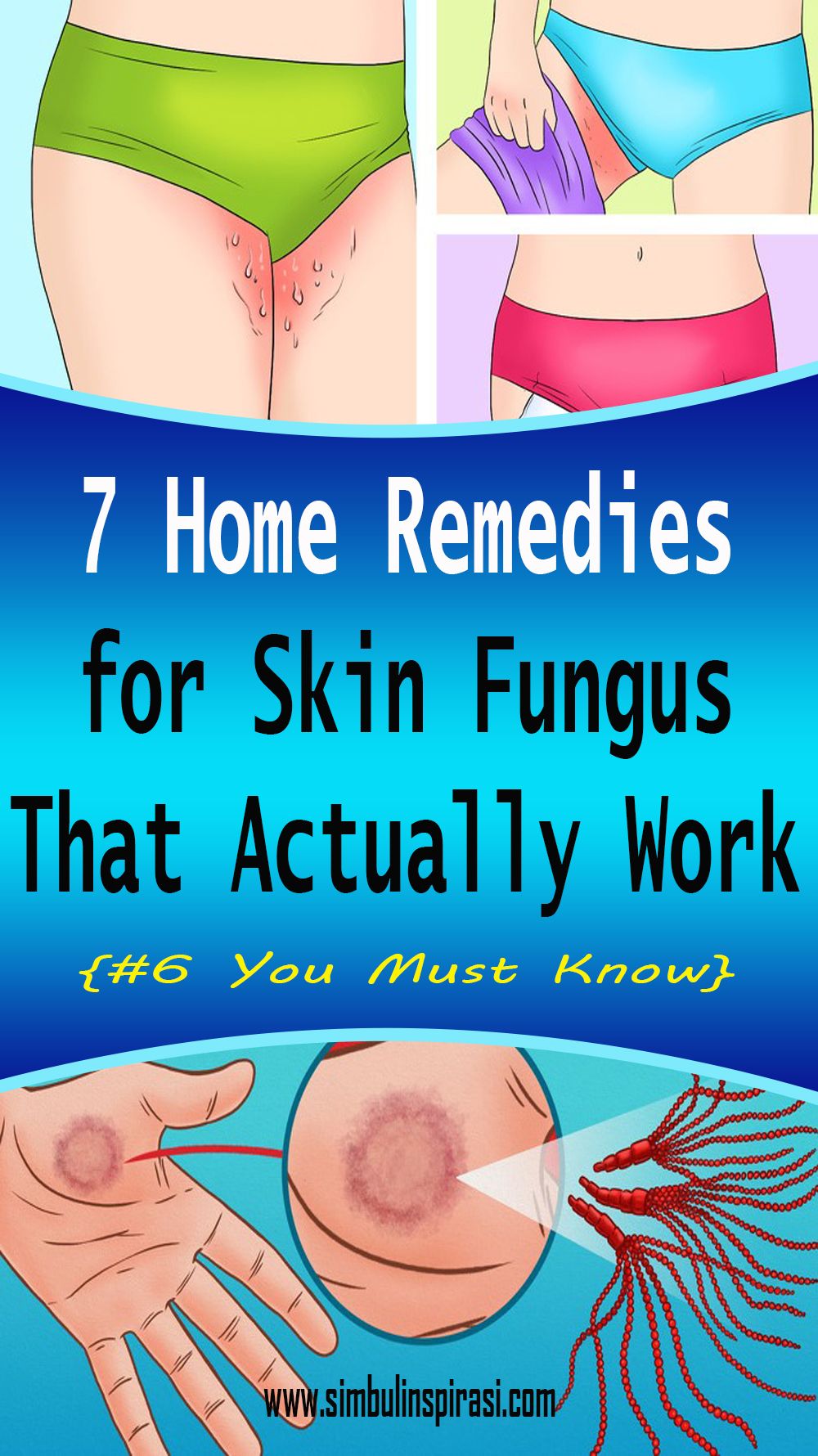 7 Home Remedies for Skin Fungus That Actually Work ...