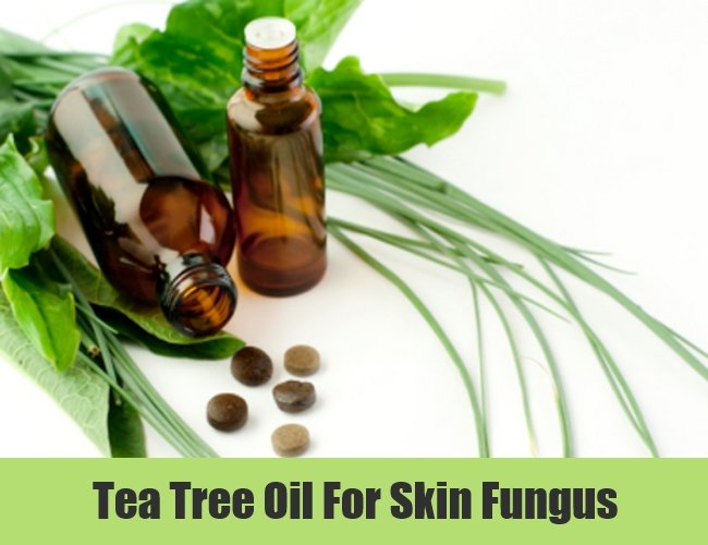 7 Skin Fungus Home Remedies, Natural Treatments And Cures ...