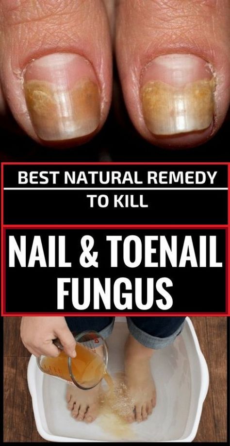 9 Best Nail images