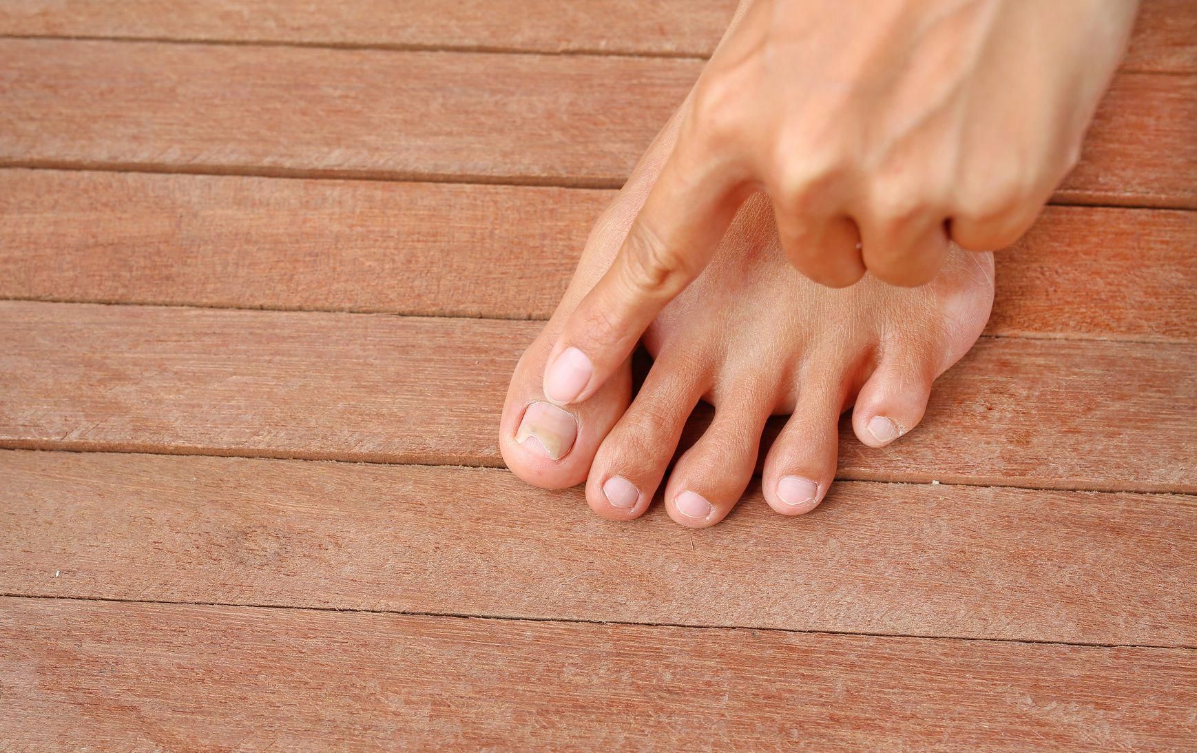 9 Things Your Feet Are Trying To Tell You About Your ...