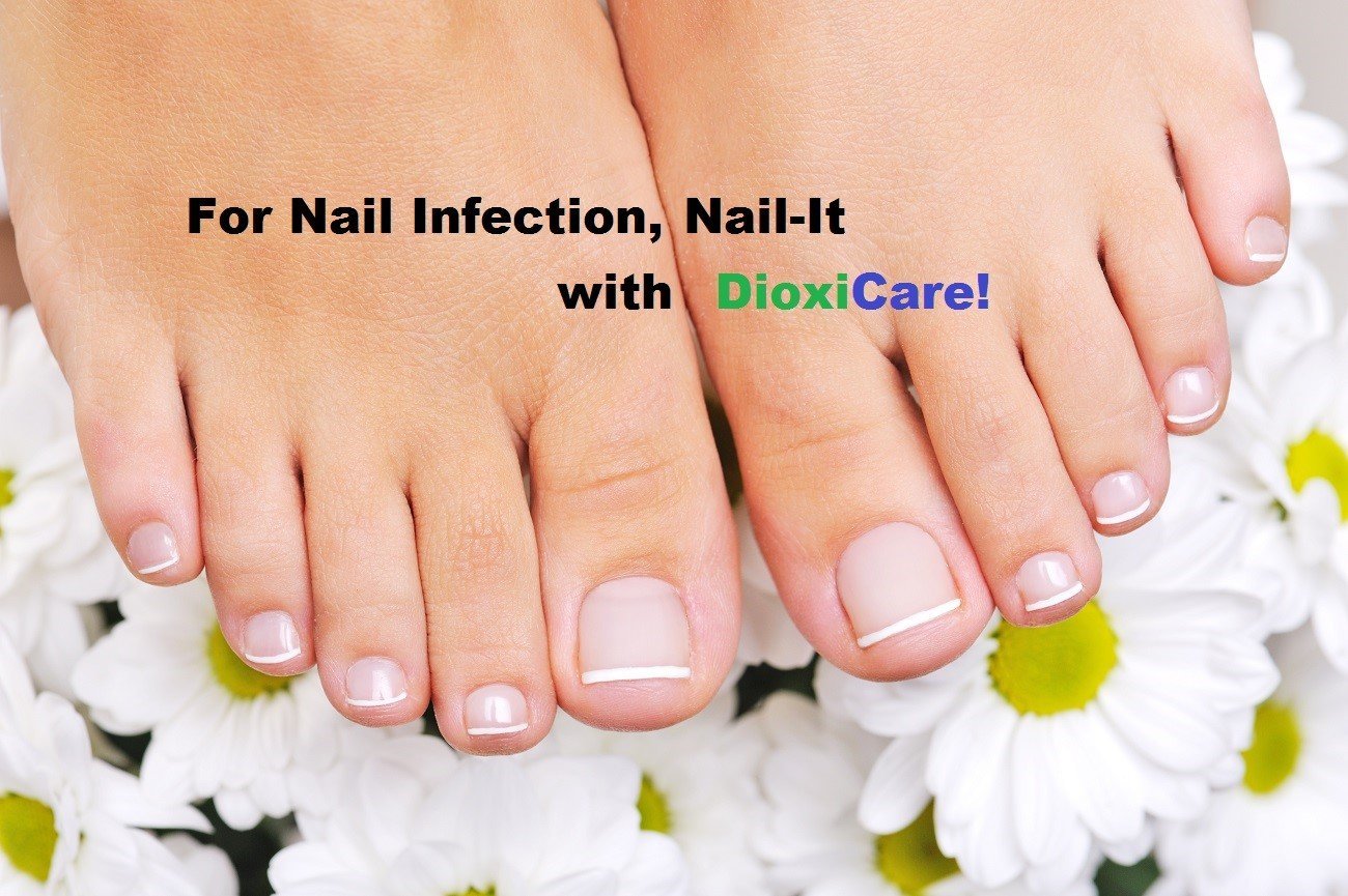 Apply Nail to Nail Infection Early Frontier Pharmaceutical ...