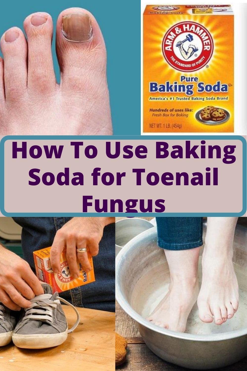 Baking Soda for Toenail Fungus