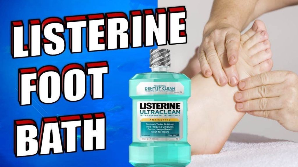 Best Listerine for Toenail Fungus in 2021 and Beyond ...