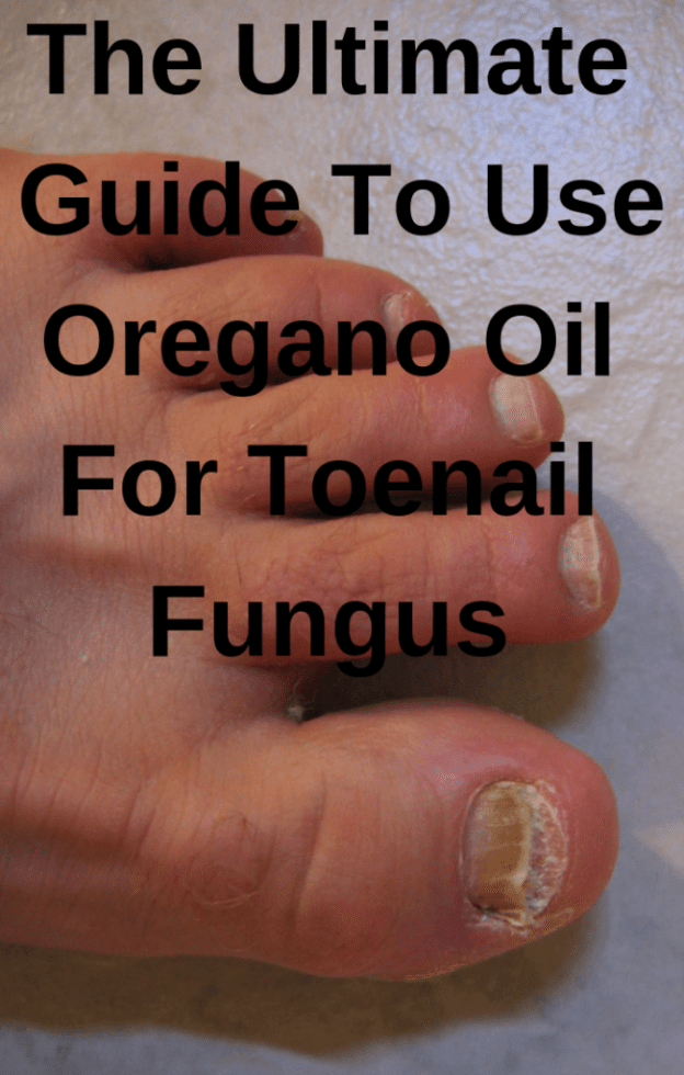 Best Oregano Oil for Toenail Fungus in 2021 and Beyond