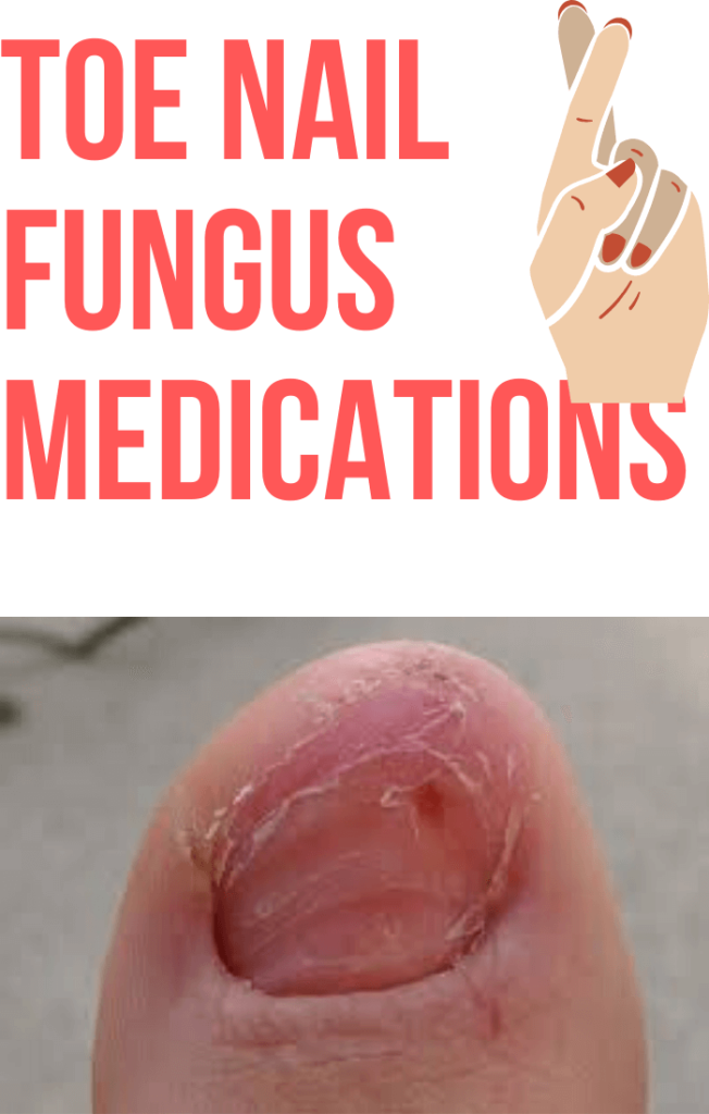 Best Toe Nail Fungus Medications: (Works Within 8 Weeks)
