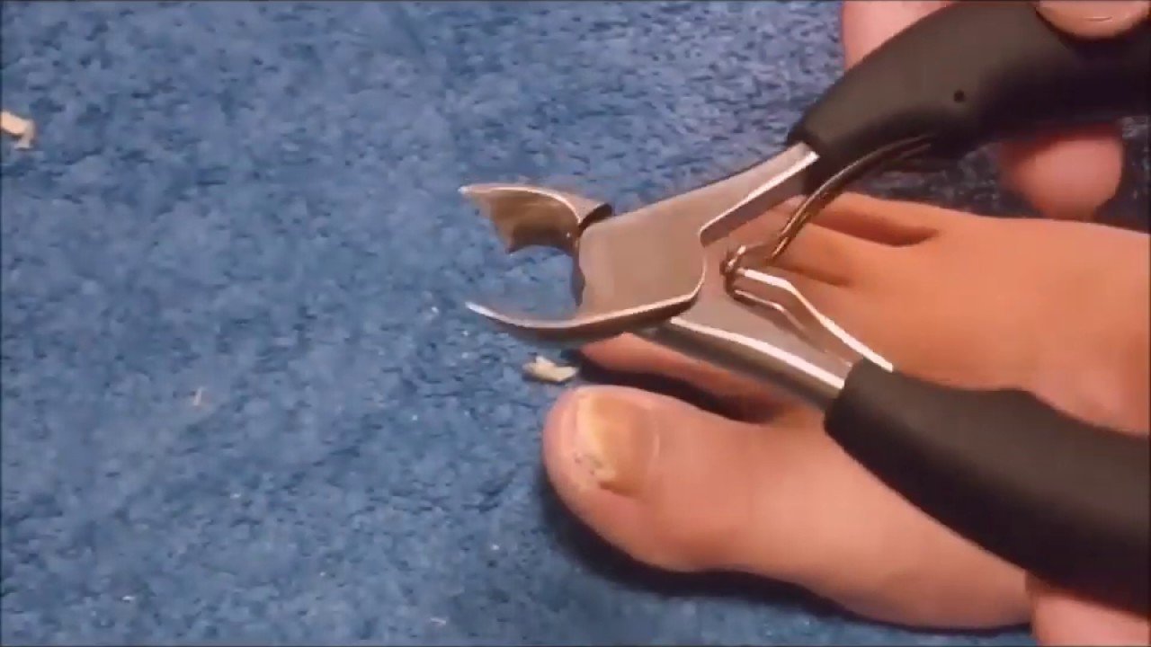 Best toenail clippers for your nail fungus