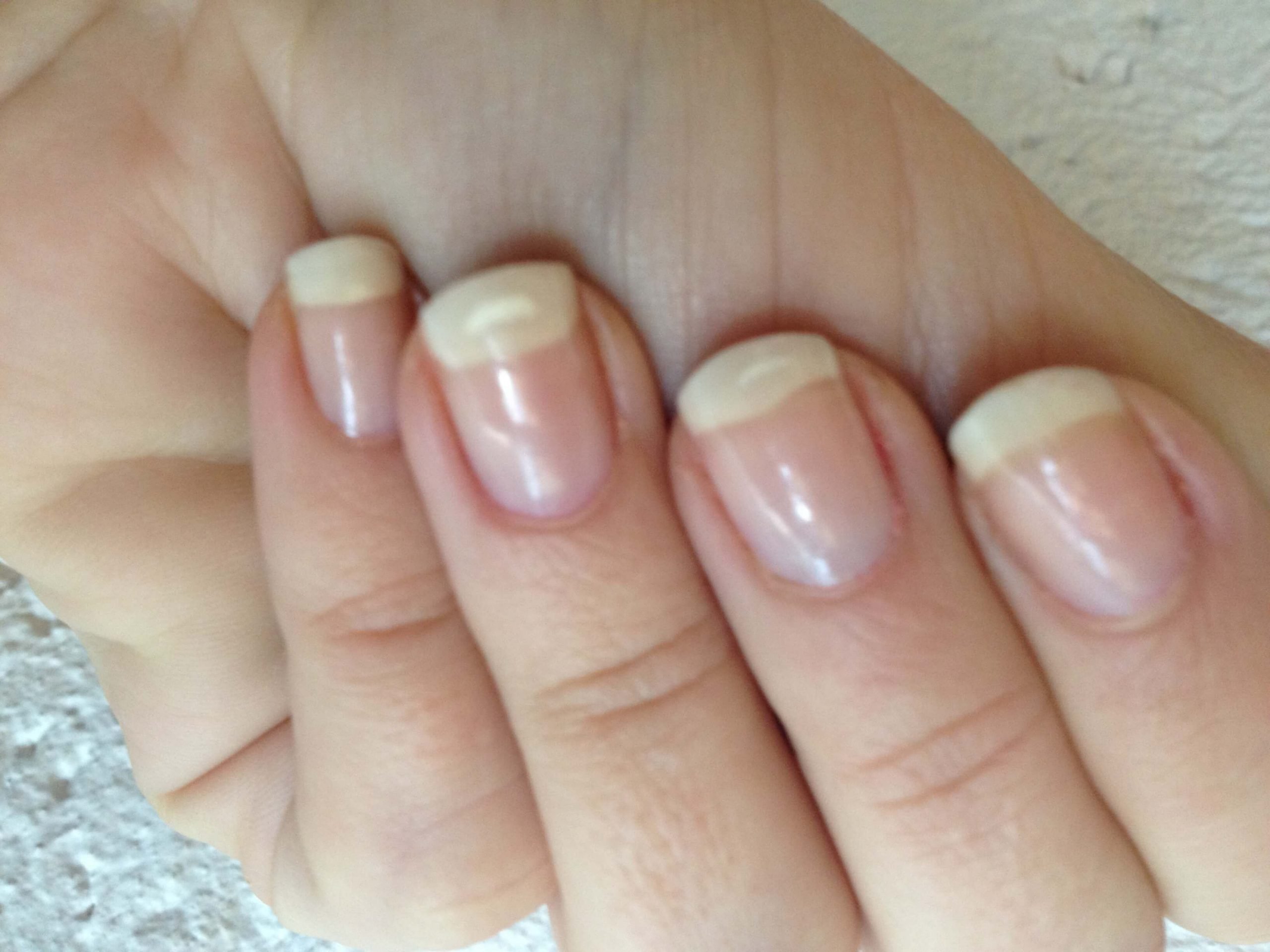 Best Treatments For Nail Recovery After Acrylics