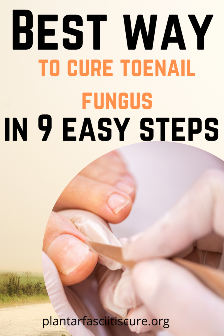 Best way to cure toenail fungus in 9 easy steps