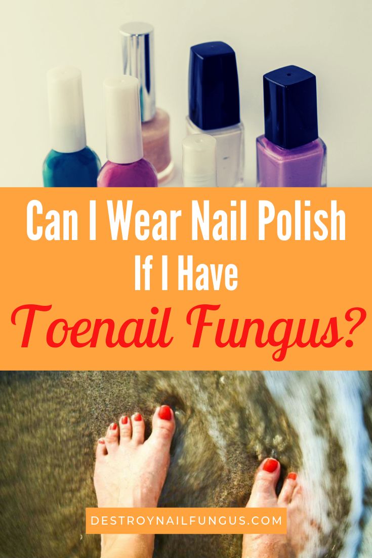 Can I Wear Nail Polish If I Have Toenail Fungus?