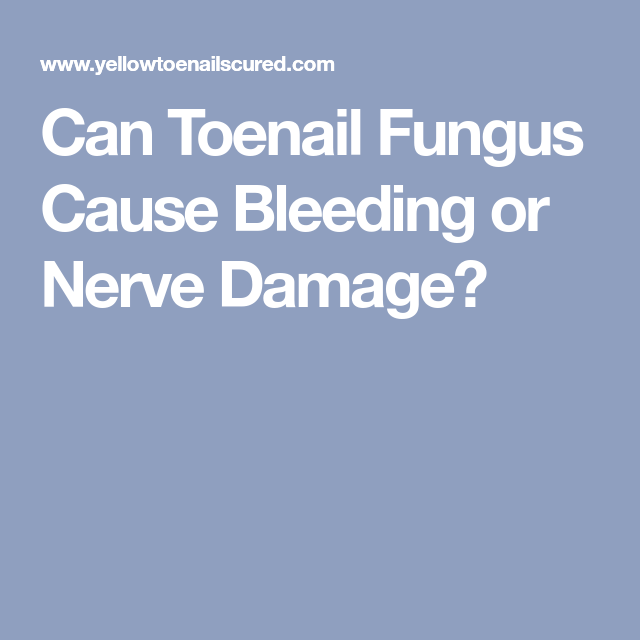 Can Toenail Fungus Cause Bleeding or Nerve Damage ...