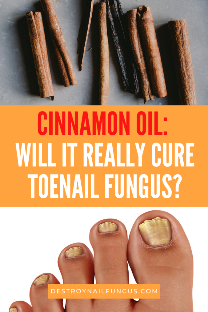Cinnamon Oil For Toenail Fungus