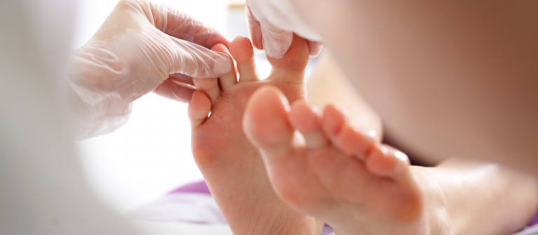 Do I need to see a doctor to treat athletes foot?