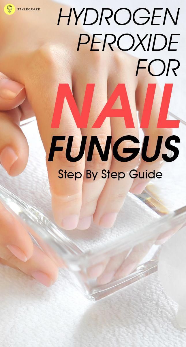 Do you have nail fungus? Are you looking for a home remedy ...