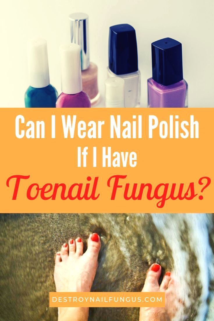 Do you have nail fungus? If so, you might be wondering ...