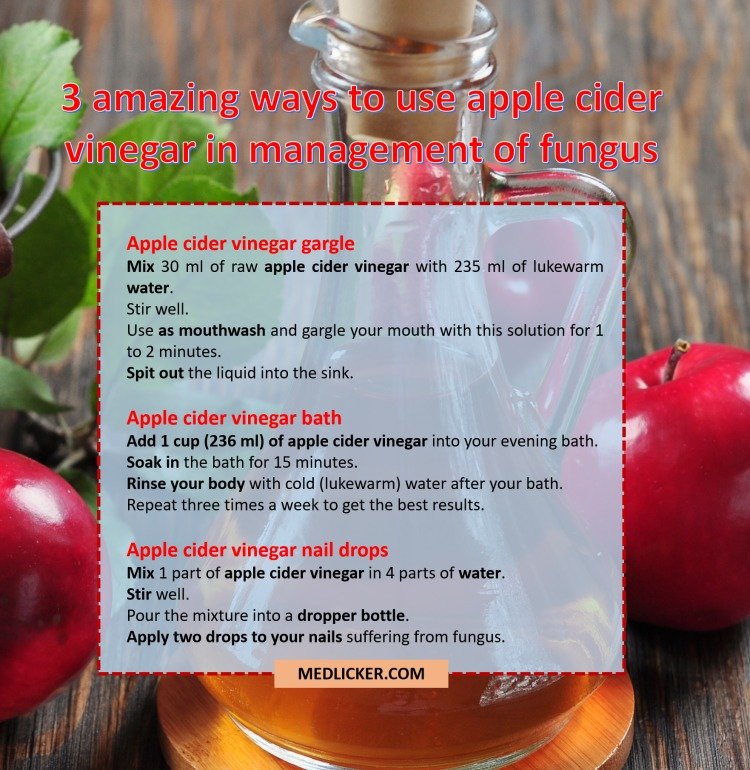 Does Apple Cider Vinegar Kill Yeast In The Body