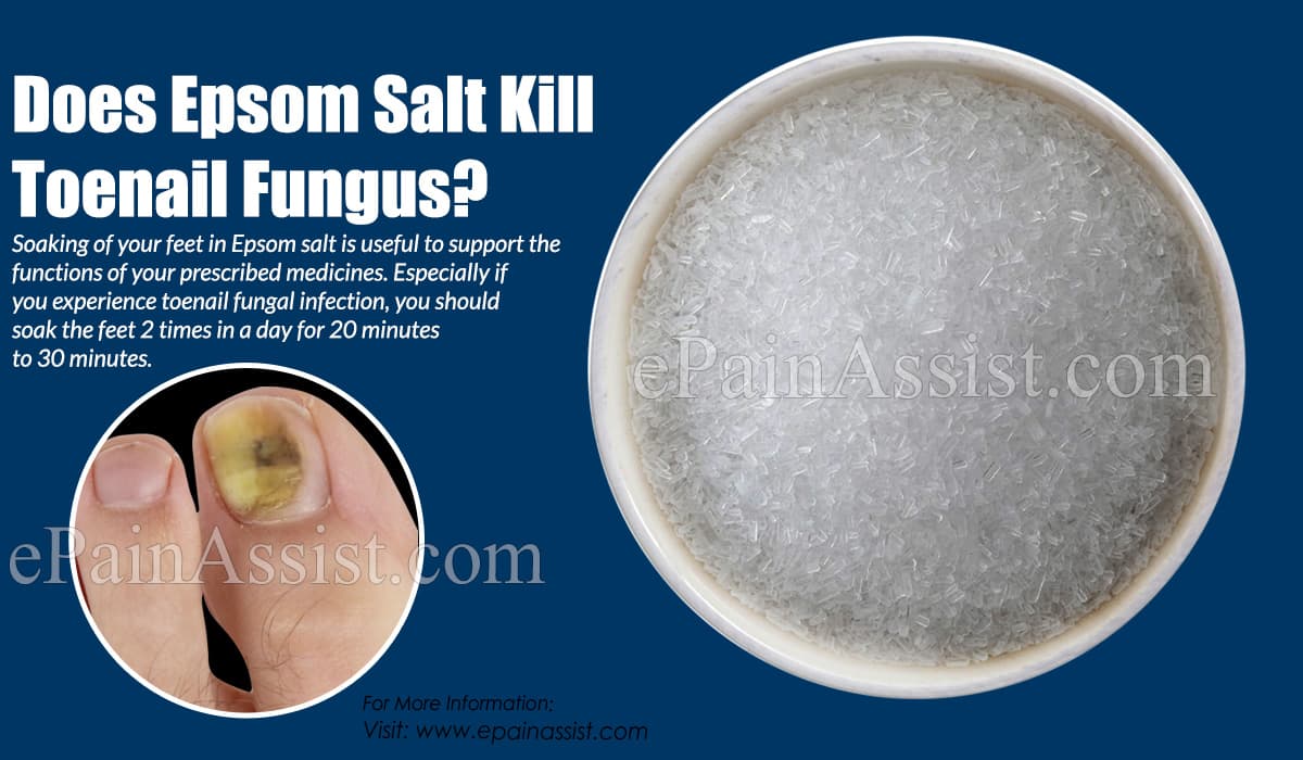 Does Epsom Salt Kill Toenail Fungus?
