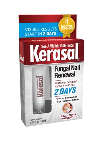 Does Kerasal Fungal Nail Renewal Treatment REALLY Work?
