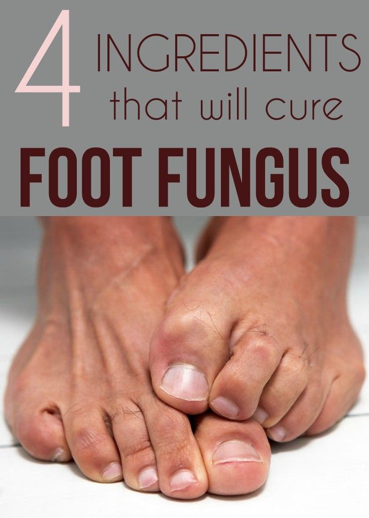 Easy steps to get rid of calluses and toenail fungus.