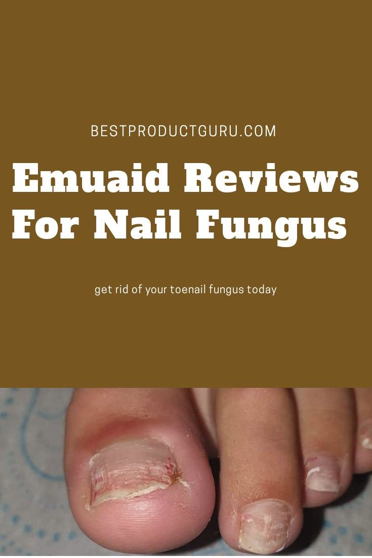 Emuaid Reviews For Nail Fungus