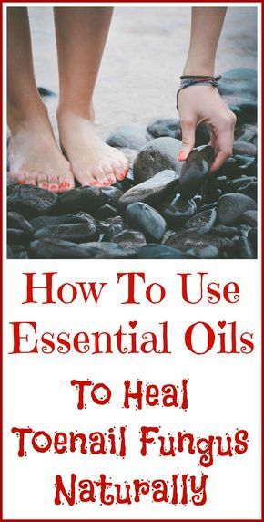 Essential Oils Good For Toenail Fungus (With images ...