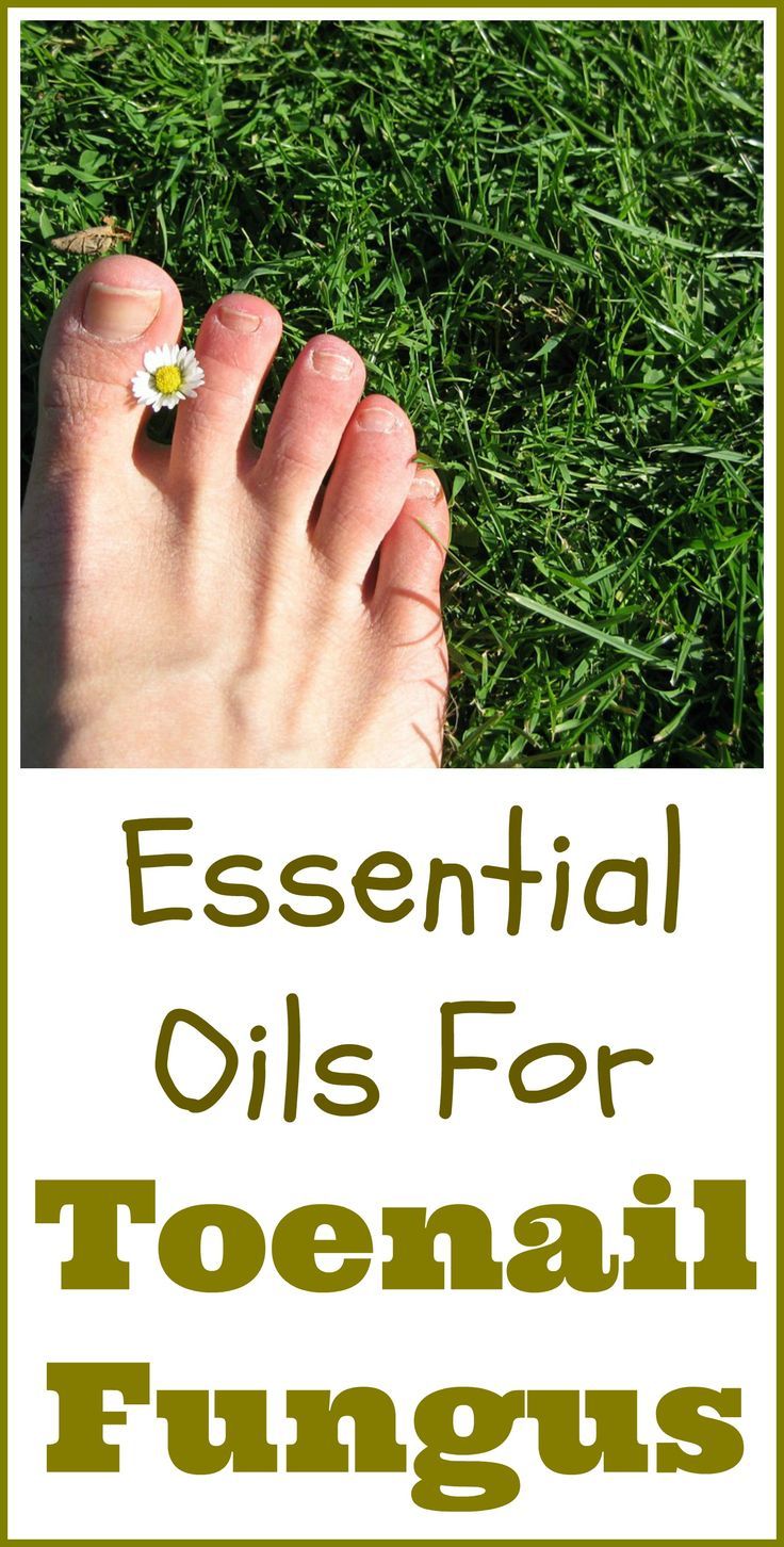 Essential oils that are often used for toenail fungus a ...