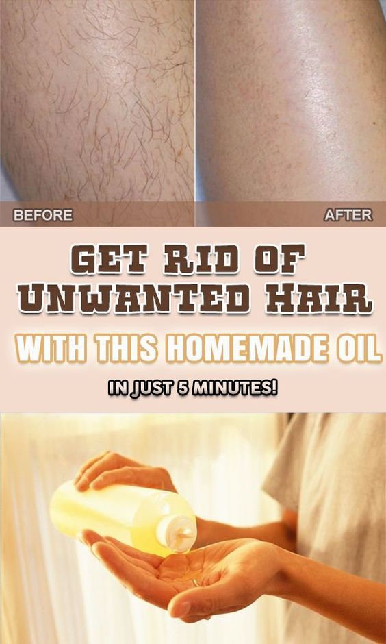 Get Rid Of Unwanted Hair With This Homemade Oil In just 5 ...
