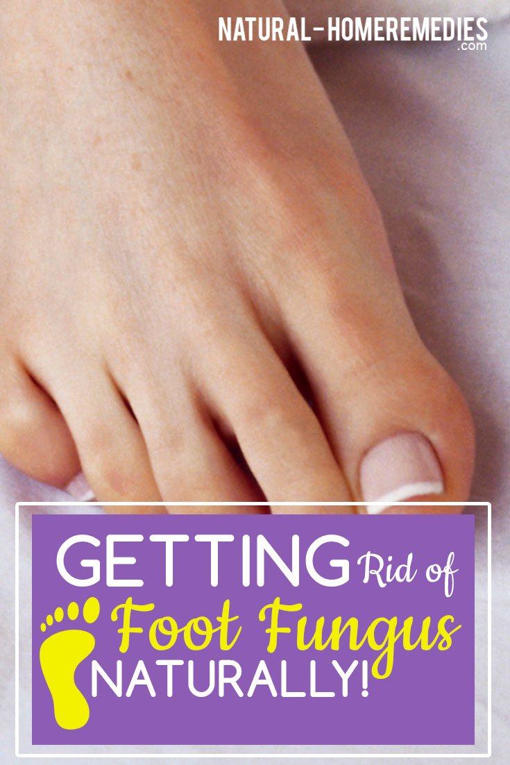 Getting Rid of Foot Fungus Naturally!  Natural Home Remedies &  Supplements