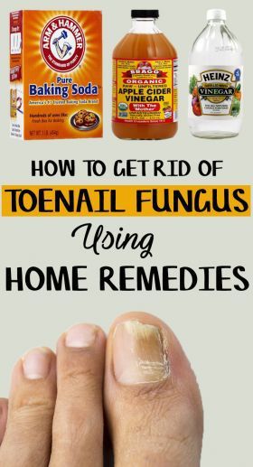 home remedies for toenail fungus