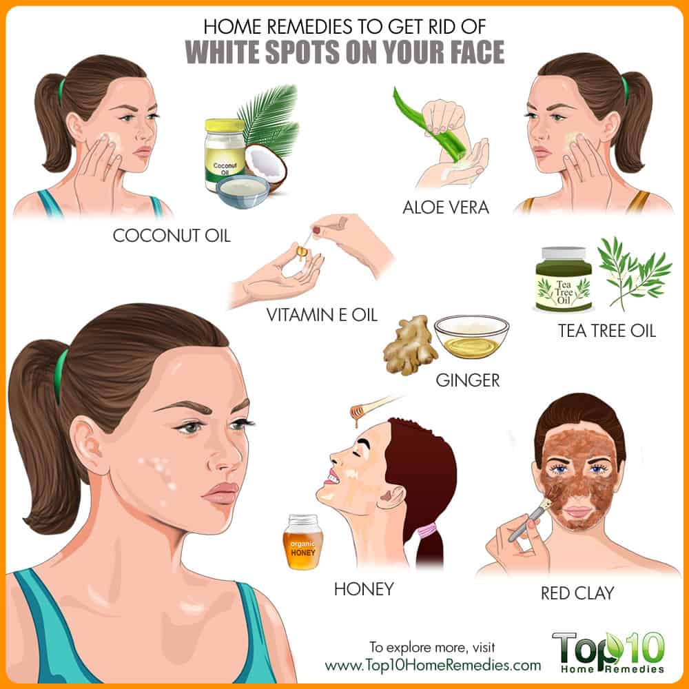 Home Remedies to Get Rid of White Spots on Face