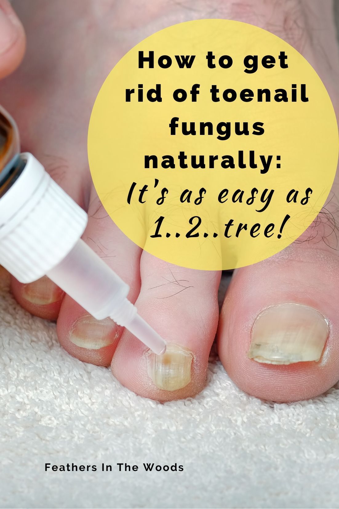 How I got rid of toenail fungus (quickly &  naturally ...
