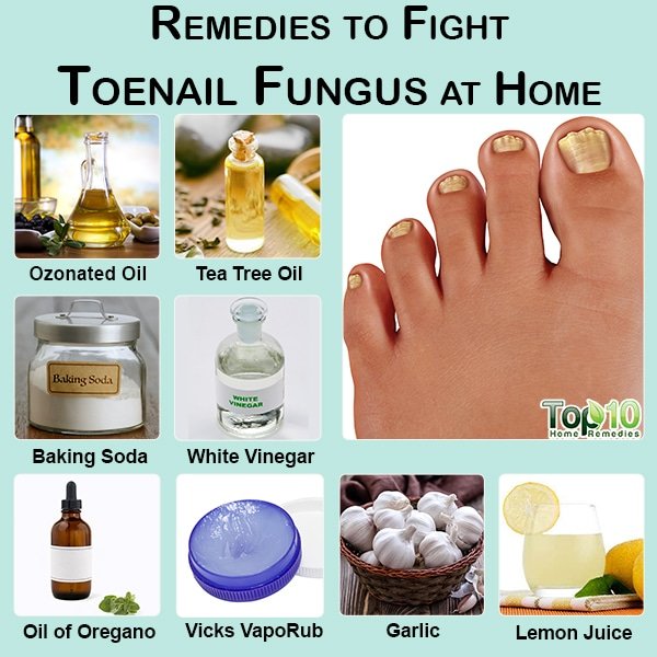 How To Cure Toenail Fungus At Home