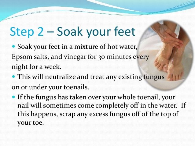 How to cure toenail fungus quickly
