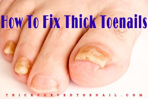 How To Fix Thick Toenails