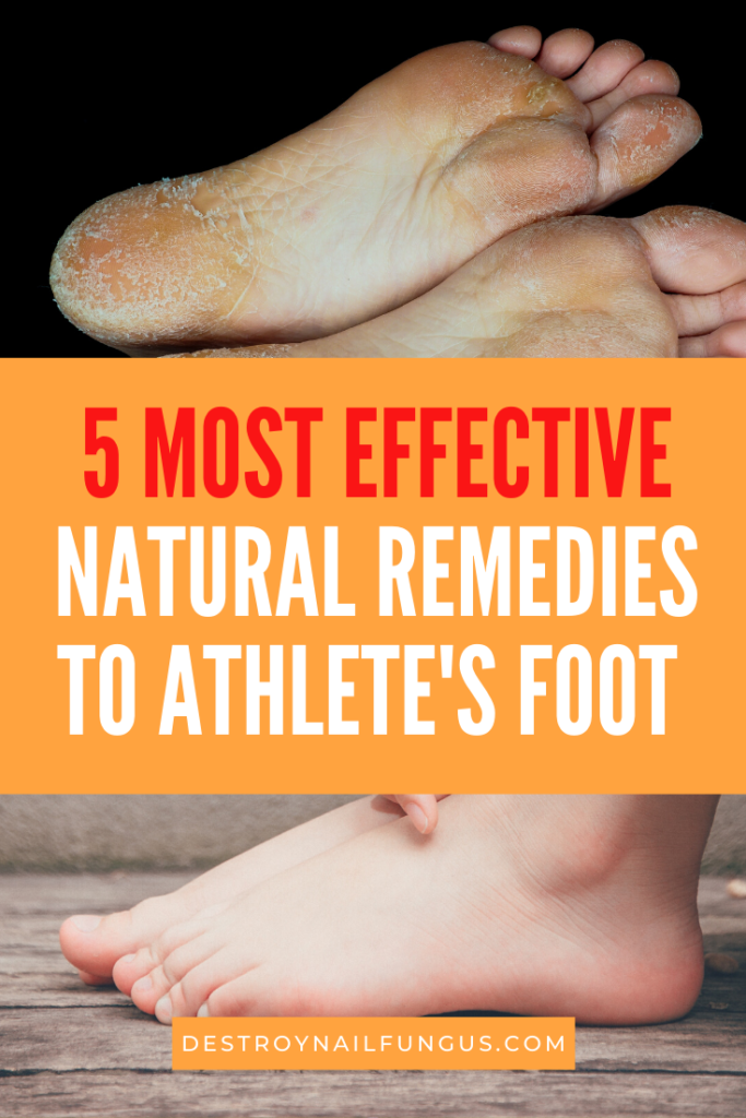 How To Get Rid Of Athletes Foot Safely And Effectively
