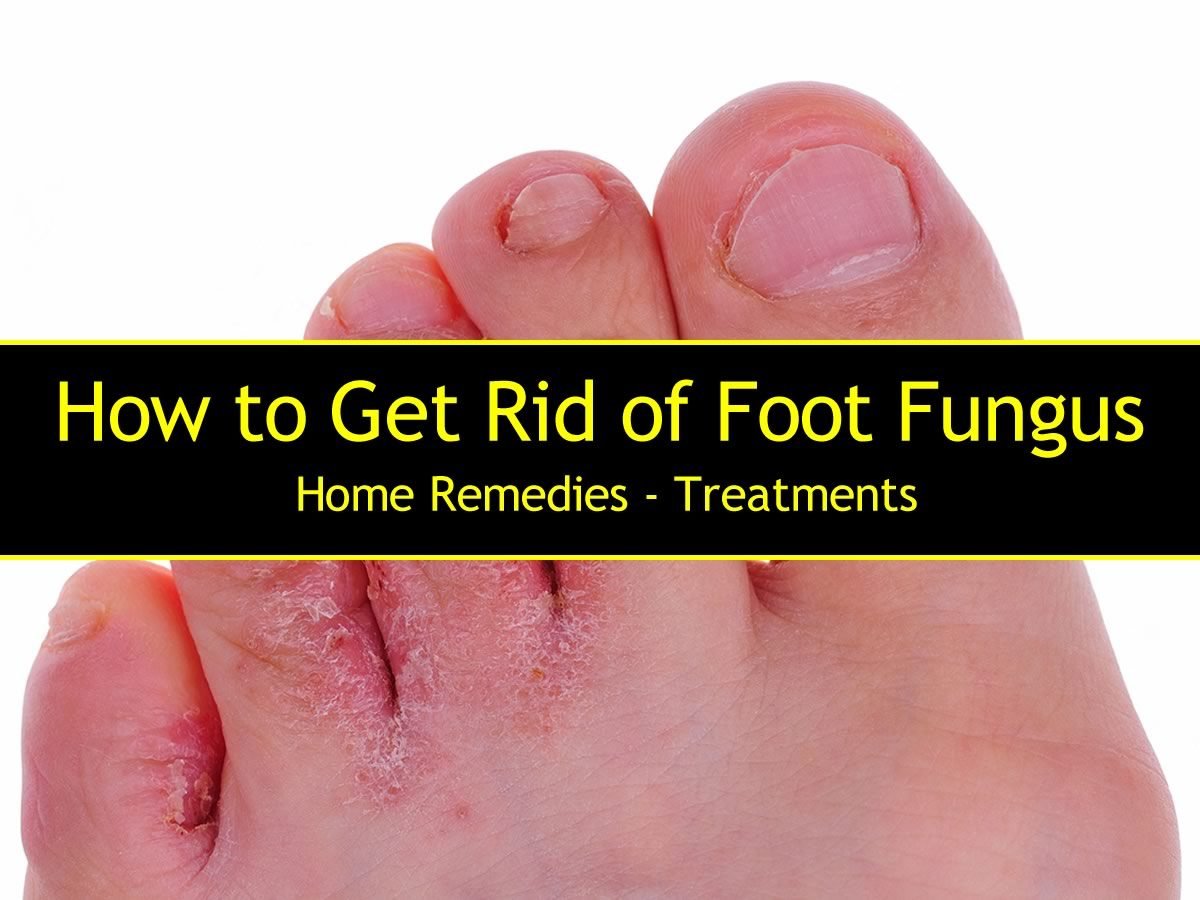 How to Get Rid of Foot Fungus Fast With Home Remedies