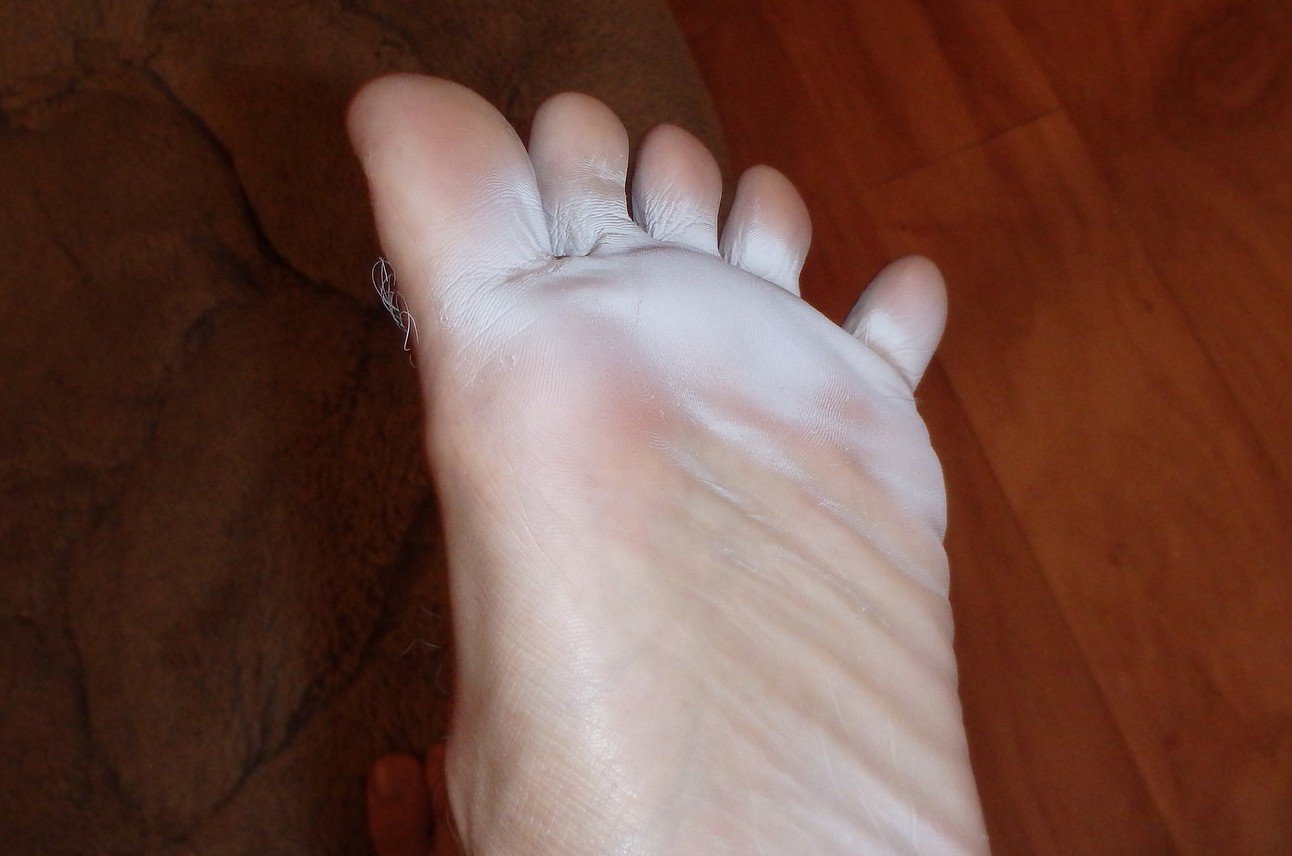 How to Get Rid Of Foot Fungus