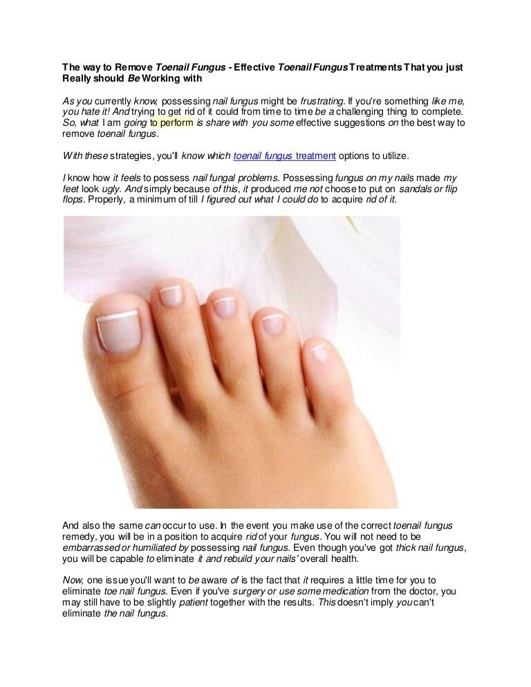 How to get rid of nail fungus