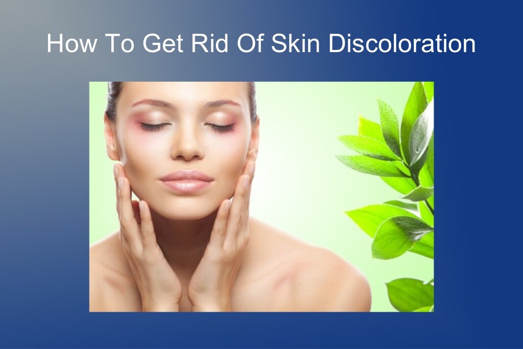How To Get Rid Of Skin Discoloration