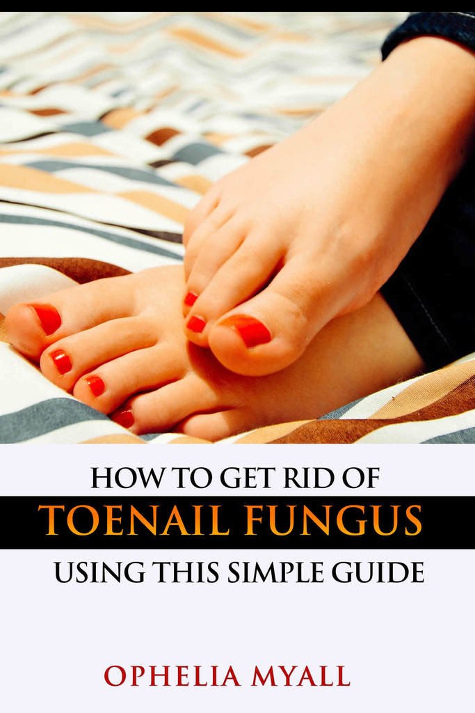 How to Get Rid of Toenail Fungus Using This Simple Guide by Ophelia ...