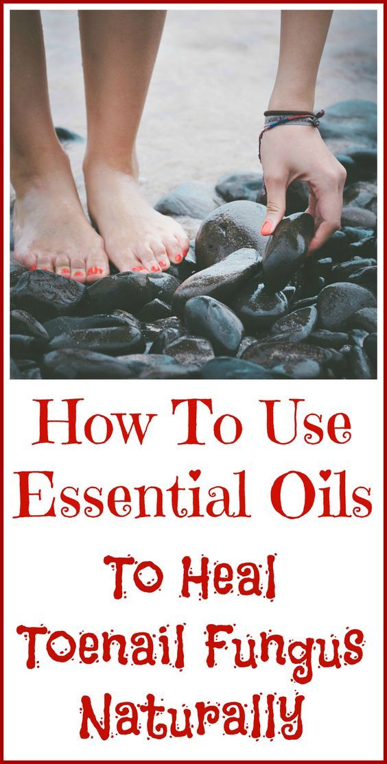 How to heal toenail fungus naturally, with essential oils ...
